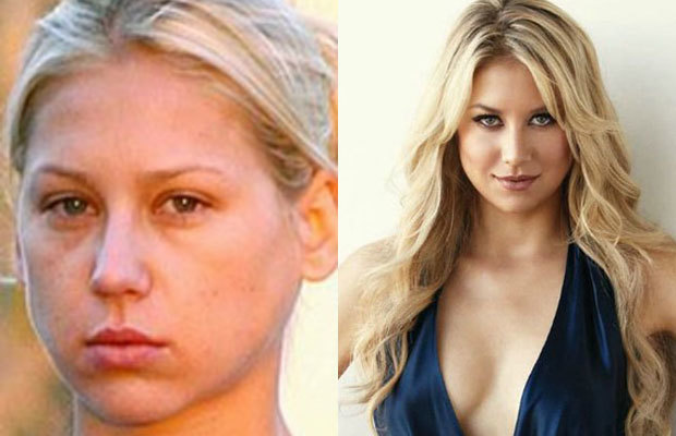 Top 40 Most Shocking Pictures Ever Made Of Celebrities Without Makeup