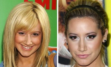 photo: beforeandafterceleb.com