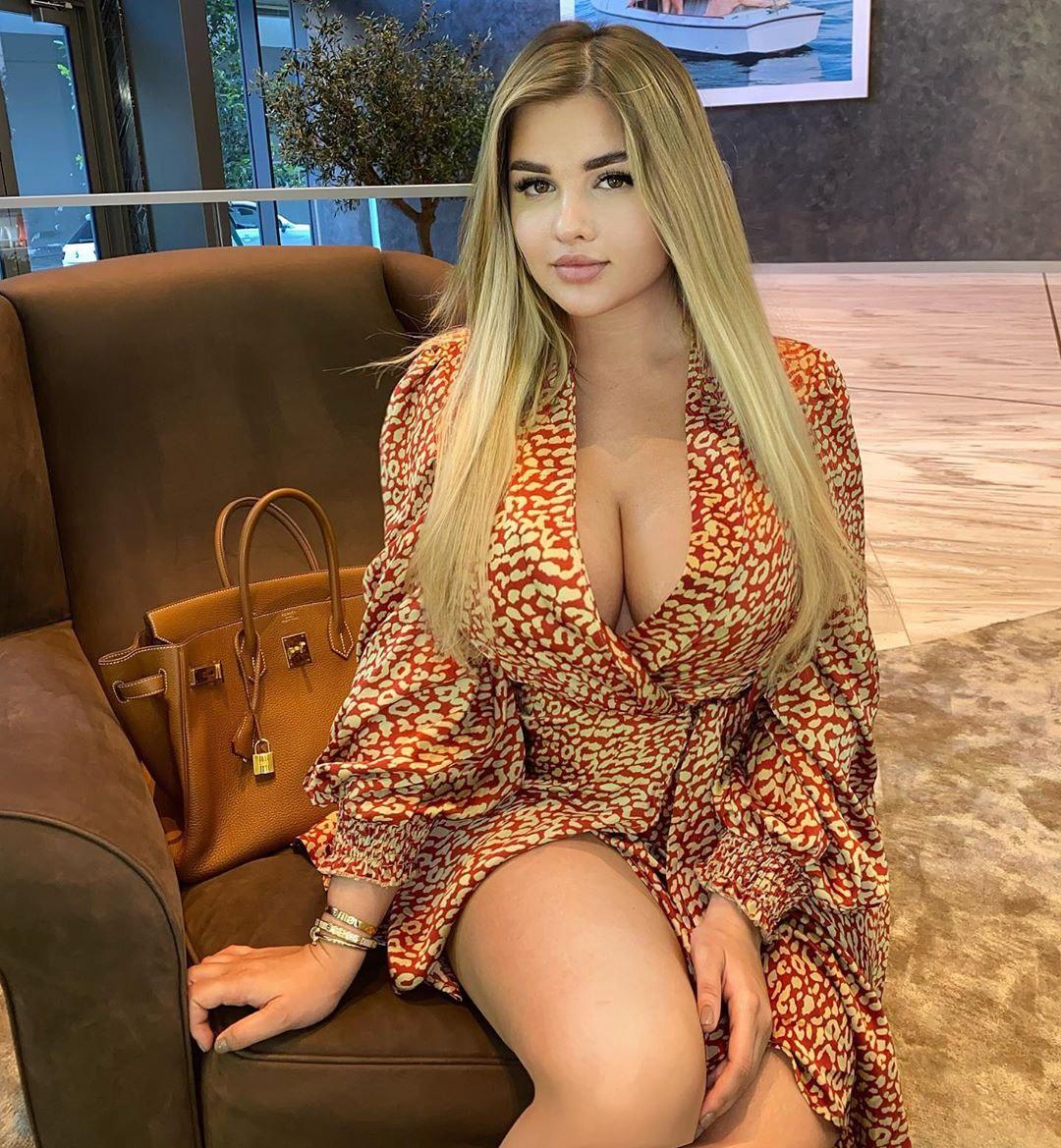 Anastasia Kvitko plastic surgery